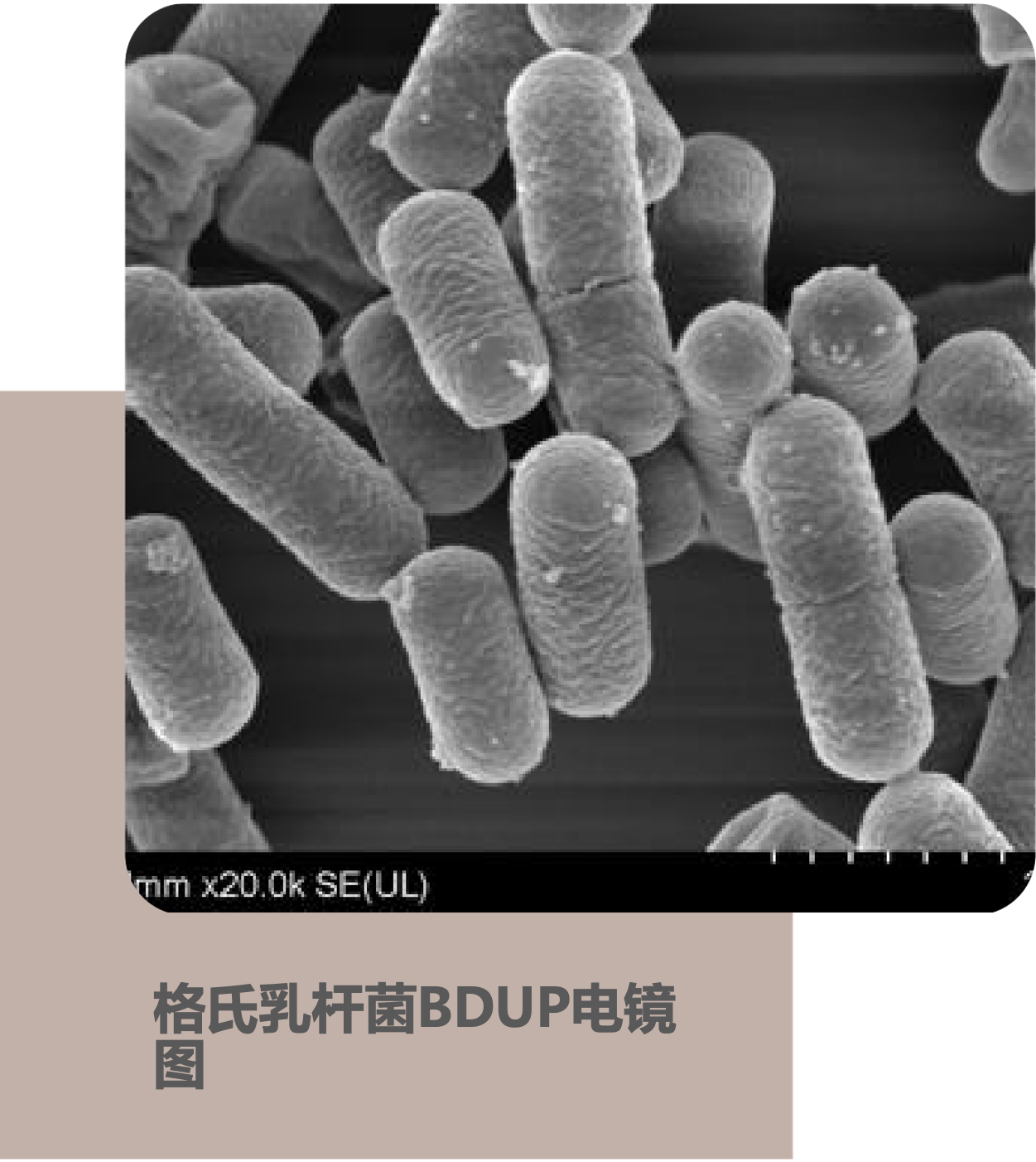 Lactobacillus gasseri BDUP under microscope